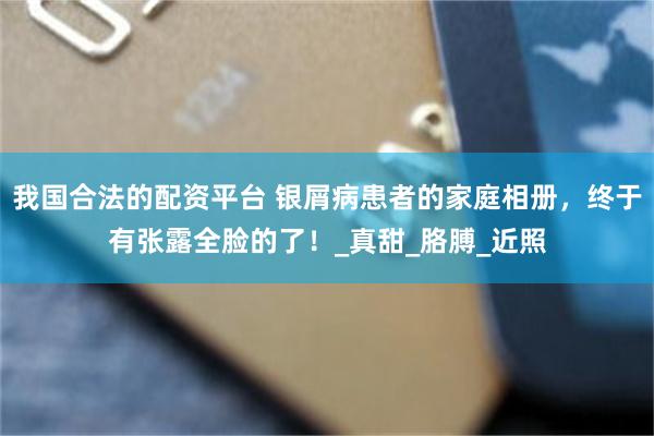 我国合法的配资平台 银屑病患者的家庭相册，终于有张露全脸的了！_真甜_胳膊_近照